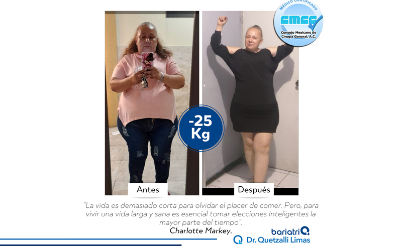 INT2-DR-QUETZALLI-LIMAS