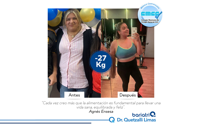 INT4-DR-QUETZALLI-LIMAS