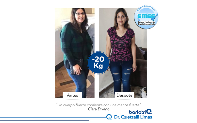 INT5-DR-QUETZALLI-LIMAS