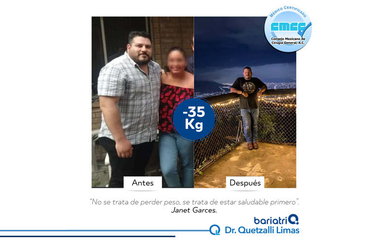 INT6-DR-QUETZALLI-LIMAS